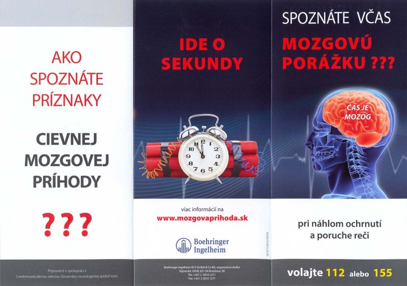 Čas je mozog - ide o sekundy